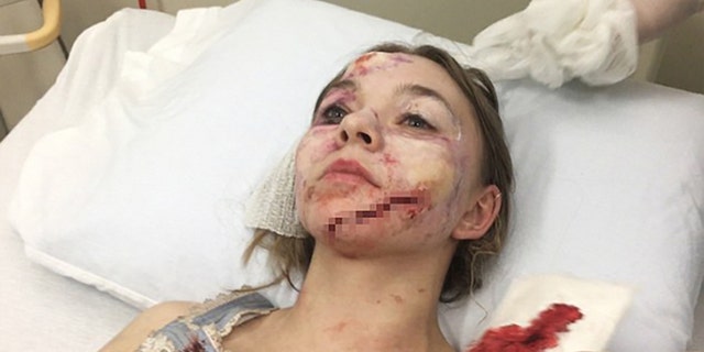 Tyson Hickson in the hospital after falling through a glass door.