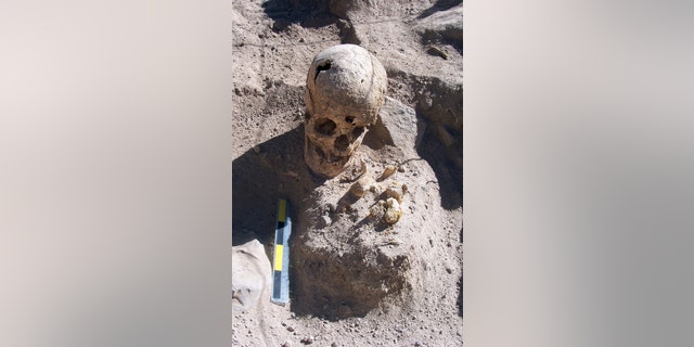 A burial of a young woman found in the middle of a tomb. Analysis of her skeletal remains reveal that she suffered dental problems, including tooth loss. At one point in her life she suffered an internal hemorrhage in the meninges of her cranium.