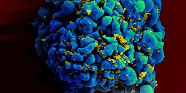 This electron microscope image made available by the National Institute of Allergy and Infectious Diseases shows an H9 T cell, colored in blue, infected with HIV, yellow.