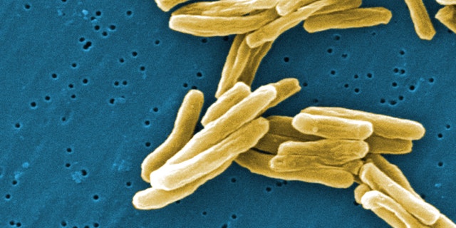 This scanning electron micrograph (SEM) depicts some of the ultrastructural details seen in the cell wall configuration of a number of Gram-positive Mycobacterium tuberculosis bacteria.
