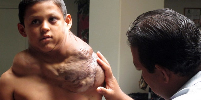 July 20, 2012: In this file photo, the father of a Ciudad Juarez-born boy suffering from a massive tumor who U.S. Homeland Security identified only as "Jose," examines his shoulder at the First Baptist Church of Rio Rancho, N.M.