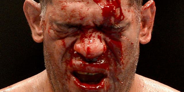 BRISBANE, AUSTRALIA - DECEMBER 07: Antonio 'Big Foot' Silva's face is full of blood during the UFC Brisbane bout between Mark Hunt and Antonio 'Big Foot' Silva of Brazil at the Brisbane Entertainment Centre on December 7, 2013 in Brisbane, Australia. (Photo by Bradley Kanaris/Getty Images)