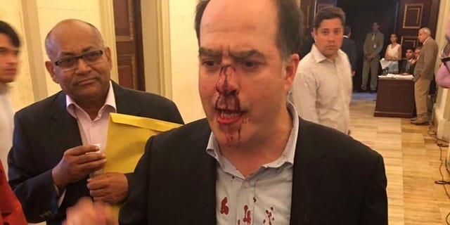 In this photo provided by Elyangelica Gonzalez, Venezuelan opposition Congressman Julio Borges arrives to the National Assembly after he was attacked by government supporters during a protest outside the National Electoral Council, CNE, in Caracas, Venezuela, Thursday, June 9, 2016. Opposition members were turned back from the headquarters of Venezuela's electoral body where the group attempted to enter to demand the government allow it to pursue a recall referendum against President Nicolas Maduro. (Elyangelica Gonzalez via AP)