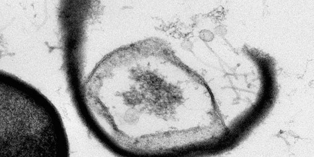 This image shows a burst open cell with phages escaping.