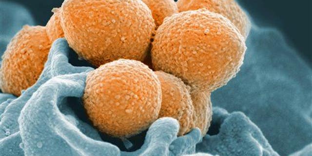 An electron microscope image of Group A Streptococcus (orange) during phagocytic interaction with a human neutrophil (blue).