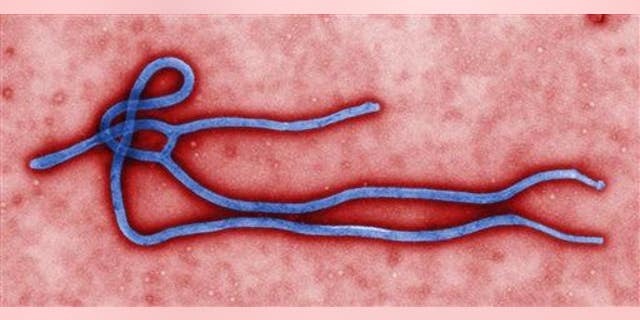 This photo provided by the CDC shows an Ebola virus. US health officials are monitoring the Ebola outbreak in Africa, but say the risk of the deadly germ spreading to the United States is remote.
