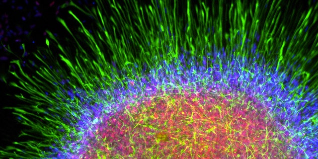 Astrosphere brain cell