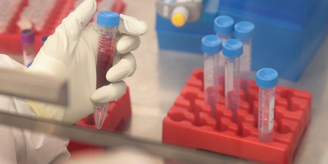 A researcher processes blood samples taken from pregnant rhesus macaque monkeys infected with the Zika virus on June 28, 2016. (Photo by Scott Olson/Getty Images)