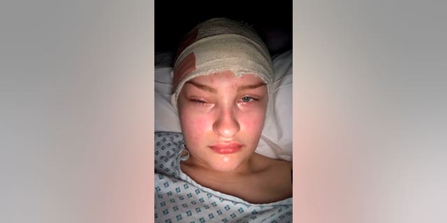Following a craniotomy, Megan Barker's eyes swelled shut. The tumor surgeons removed is suspected to be a mass of calcium.