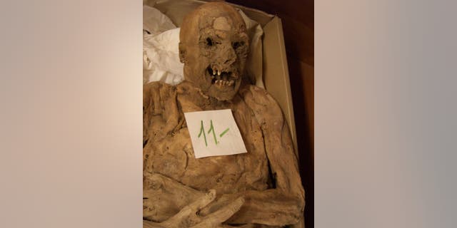 A Hungarian mummy's genes is helping scientists better understand the causes of colorrectal cancer. (Tel Aviv University)