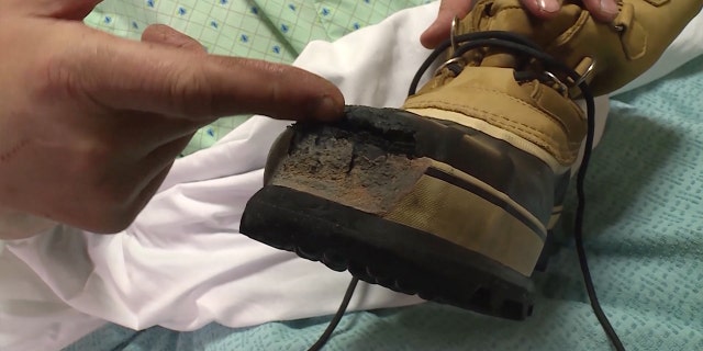 The 60-year-old said he had a hole in one of his boots because a fire he started on the first night set his pants and boot ablaze.