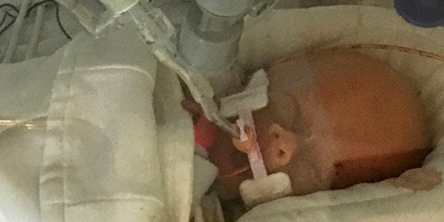 Life Lynn DeKlyen lies in the Neonatal Intensive Care Unit of the University of Michigan Hospital in Ann Arbor, Mich., Saturday.