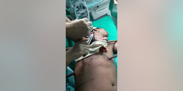 The two iron rods measuring two-and-a-half feet each pierced his abdomen and chest.