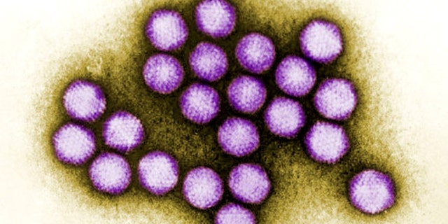 An image of adenovirus, a type of virus known to cause respiratory infections, diarrhea and other problems, in humans, was among the many viruses, many of them previously unknown to turn up in samples of raw sewage.