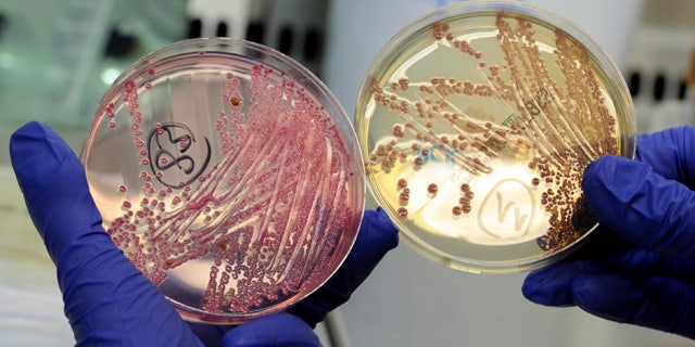 An employee holds petri dishes with bacterial strains of EHEC bacteria (bacterium Escherichia coli) in the microbiological laboratory of the Universitaetsklinikum Hamburg-Eppendorf (University Clinic Eppendorf- UKE) in the northern German town of Hamburg, June 2, 2011.