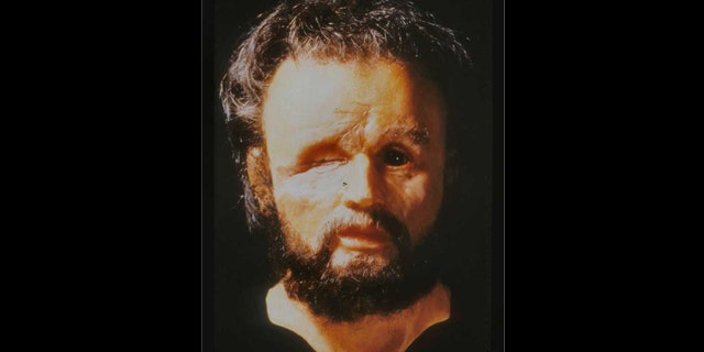 Facial reconstruction of the mystery skeleton done by medical illustrator Richard Neave, purporting to show Philip II with his famous eye wound.