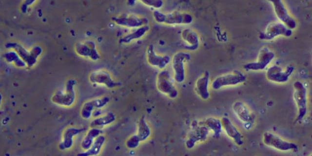 Naegleria fowleri, the brain-eating amoeba that causes primary amebic meningoencephalitis, can be caught in warm water locations.