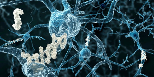 amyloid plaques istock 2.jpg