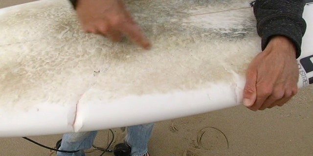 In this photo taken from video, Marcel Brunder, 37, shows the teeth marks on his surf board after being attacked while surfing, Tuesday, Aug. 29, 2017, in the waters near Lorne, 140 kms. (90 miles) southwest of Melbourne, Australia.