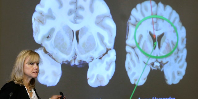 Ann McKee addresses an audience Thursday, Nov. 9, 2017 about the study of NFL football player Aaron Hernandez's brain, projected on a screen, behind right, in Boston.