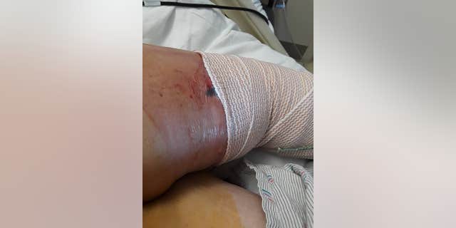 Tammy has been hospitalized for 40 days, her husband said.