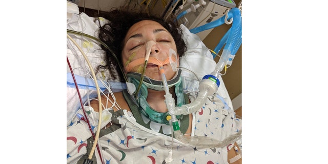 This photo of State Rep. Katie Arrington was taken the day after the head-on collision.