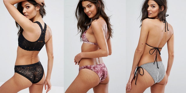 ASOS is using unedited photos of models with stretch marks and birth marks