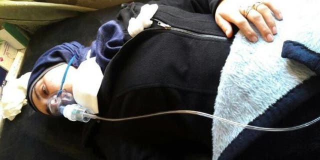 Aya Fadl, lies on a bed, with an oxygen mask to heal breathing difficulties following a suspected chemical attack on her town of Khan Sheikhoun, in the northern province of Idlib, Syria, Wednesday, April 5, 2017. Aya had ran from her house, with her 20-month old baby, and husband, thinking she could find safety from the toxic gas engulfing her town. Instead, on the street, she was confronted face to face by the horror of it. A pick-up truck piled with the bodies of the dead, including some of her own relatives. In all, she lost more than a dozen family members in the suspected chemical attack, including a twin babies.