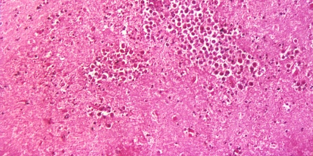 Naegleria fowleri, the brain-eating amoeba that causes primary amebic meningoencephalitis.