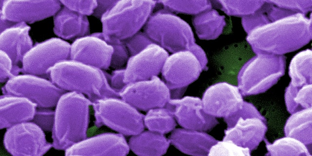 File photo: Spores from the Sterne strain of anthrax bacteria (Bacillus anthracis) are pictured in this handout scanning electron micrograph (SEM) obtained by Reuters May 28, 2015. (REUTERS/Center for Disease Control)