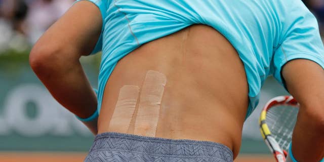 Strapping tape is seen on Spain's Rafael Nadal back during his fourth round match of the French Open tennis tournament against Serbia's Dusan Lajovic at the Roland Garros stadium, in Paris, France, Monday, June 2, 2014. Nadal won in three sets 6-1, 6-2, 6-1. (AP Photo/Michel Spingler)