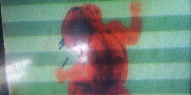 Image from security X-ray scanner at Ninoy Aquino International Airport in the Philippines shows 2-month-old infant. The baby's mother tried to smuggle her son in a backpack through security before officials stopped her.