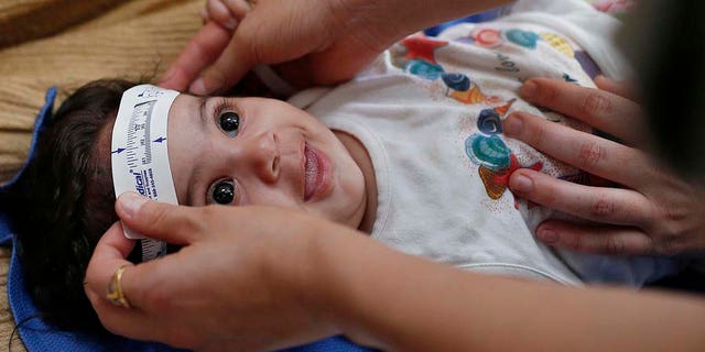 FILE - In this Wednesday, Feb. 24, 2016 file photo, 3-month-old Esther Kamilly has her head measured by Brazilian and U.S. health workers from the United States' Centers for Disease Control and Prevention (CDC) at her home in Joao Pessoa, Brazil, as part of a study on the Zika virus and the birth defect microcephaly. As the international epidemic of Zika has unfolded and led to devastating birth defects for at least 1,300 children in eight countries, an agonizing question has persisted: What is the chance that an infected pregnant woman will have a baby with these defects? (AP Photo/Andre Penner)