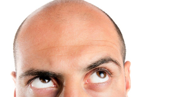 Research suggests being short and white may raise your risk of going bald |  Fox News
