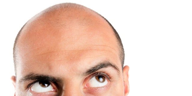 Research suggests being short and white may raise your risk of going bald | Fox News Research suggests being short and white may raise your risk of going bald | Fox News