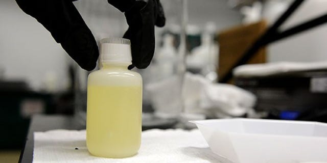 A urine sample used in the Army research project (U.S. Army)