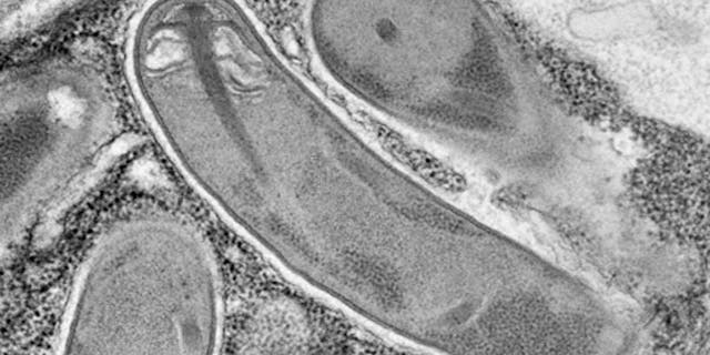A new species of the tiny parasite was found in roundworms living in Parisian compost. Its spore – the stage that infects a host cell – is show above.