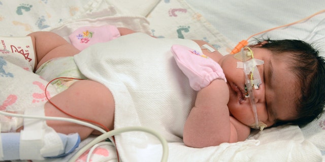 Dec. 2, 2014: This image provided by Children’s Hospital Colorado shows Mia Yasmin Garcia shortly after birth.