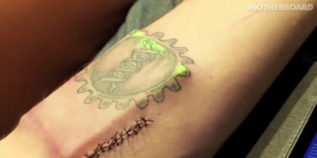 Biohacker Tim Cannon had a battery-powered electronic device installed in his arm.