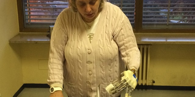Almerina Mascarello, seen above, was able to use a bionic hand being developed by researchers in Italy.