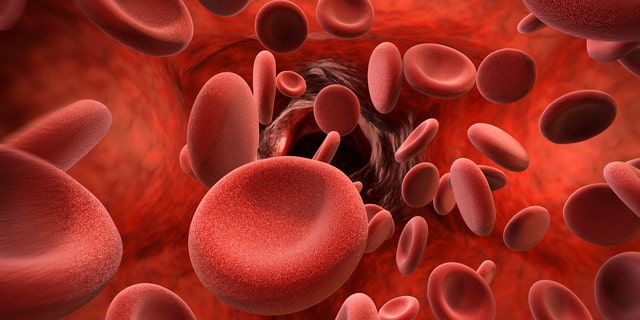 Tracy Antonelli and her daughters have a blood disorder called thalassemia