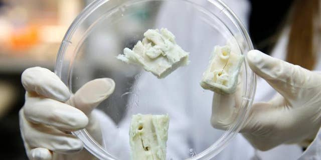 Bonus_bonegraft