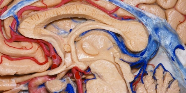 Here, the brain has been neatly sliced in half.
