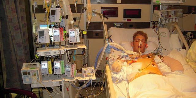 John Peck during his recovery after losing both of his arms and legs in an explosion in Afghanistan.