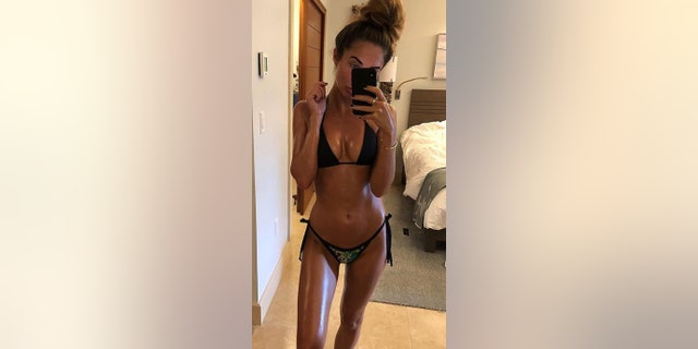 Megan McKenna said online trolls taunted her over fluctuating weight, which is a painful side effect of IBS.