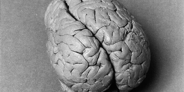 The speechless patient called 'Tan' who allowed Paul Broca to tie a specific brain region to language has been identified as Louis Leborgne.