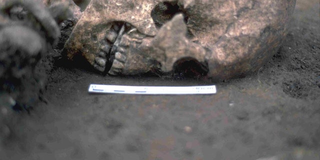 The man's skeleton was found with a flat stone in his mouth, and a new study indicates that his tongue may have been amputated when the man was alive.