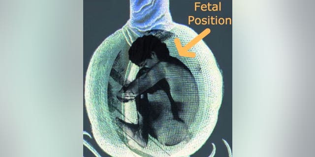 When a person dies, his or her body is placed inside the pod in the fetal position. A pre-selected tree is then planted above ground directly on top of the pod, and roots from the tree absorb nutrients from the decaying body.