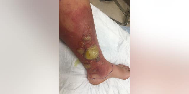 "The pictures speak for themselves; it’s crazy to see how fast something like this can happen," she said.