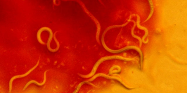 C. elegans crawling on deadly S. marcescens bacteria in a petri dish.